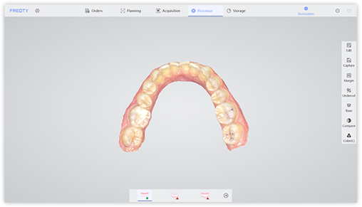 Implantation 1