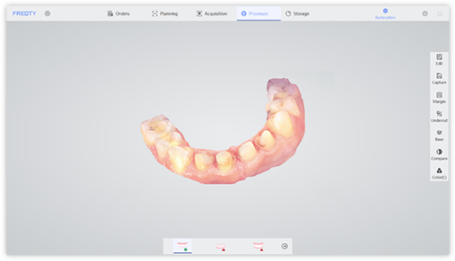 Implantat 2