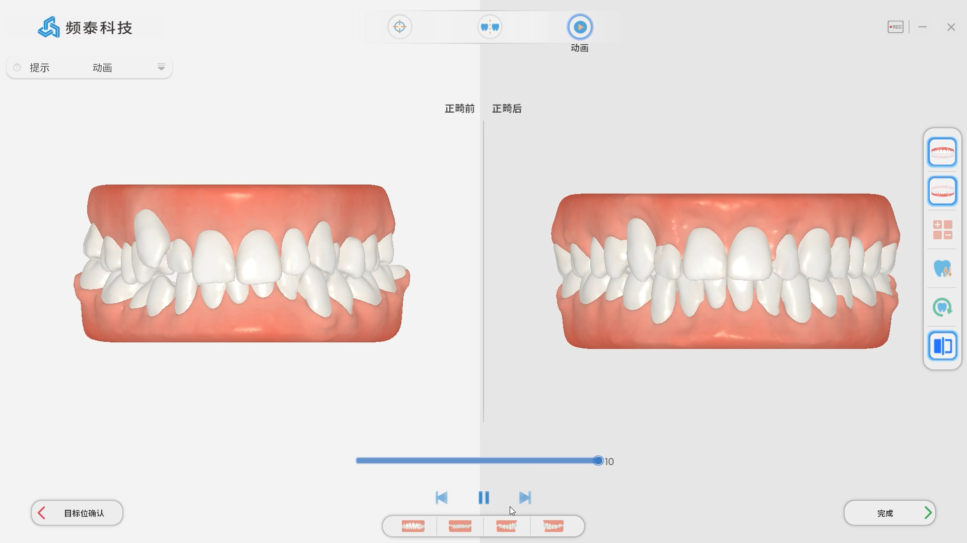 Panda Scanner Orthodontic Simulation Intelligent Upgrade