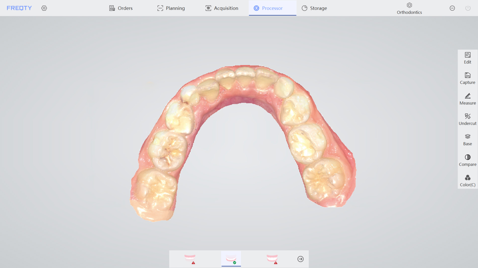 orthodontie 1