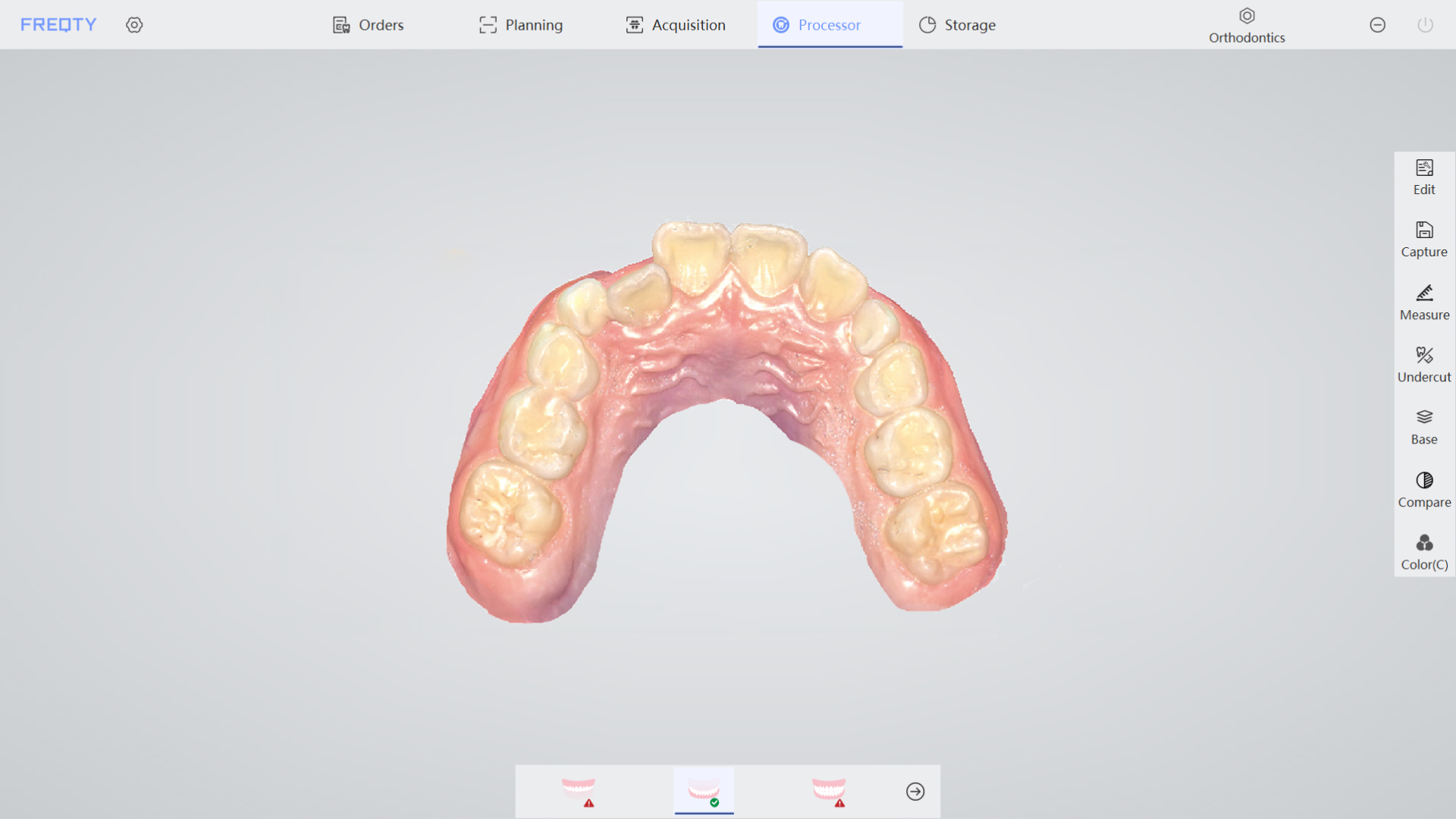 orthodontie 2